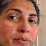 Dr. Janice Mathew, Karippurath, U.S.A. (10)
